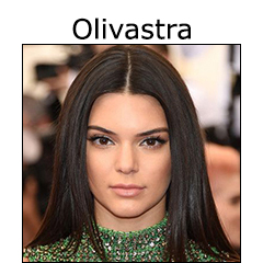 Risposta D