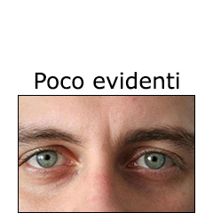 Risposta A