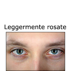 Risposta B